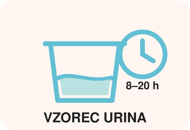 Vzorec urina za ovulacijski test