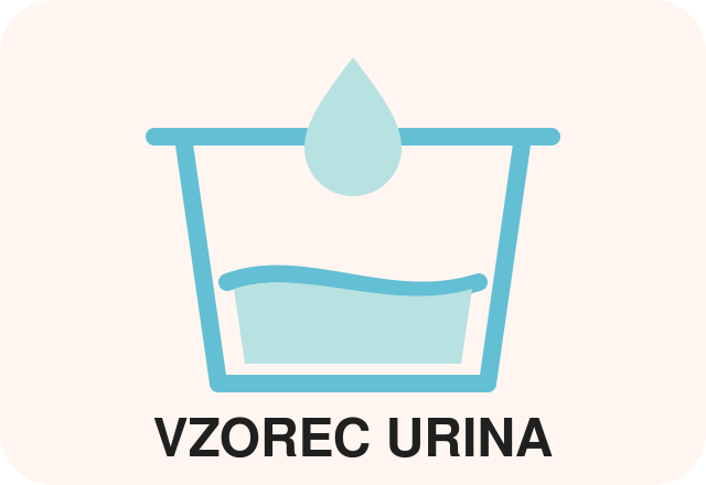 Vzorec urina za test nosečnosti