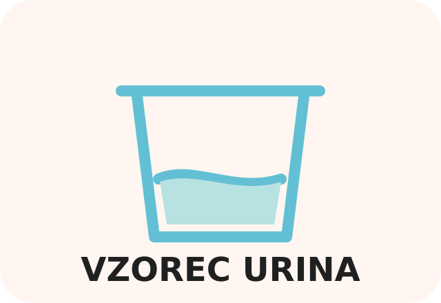Zbiranje vzorca urina
